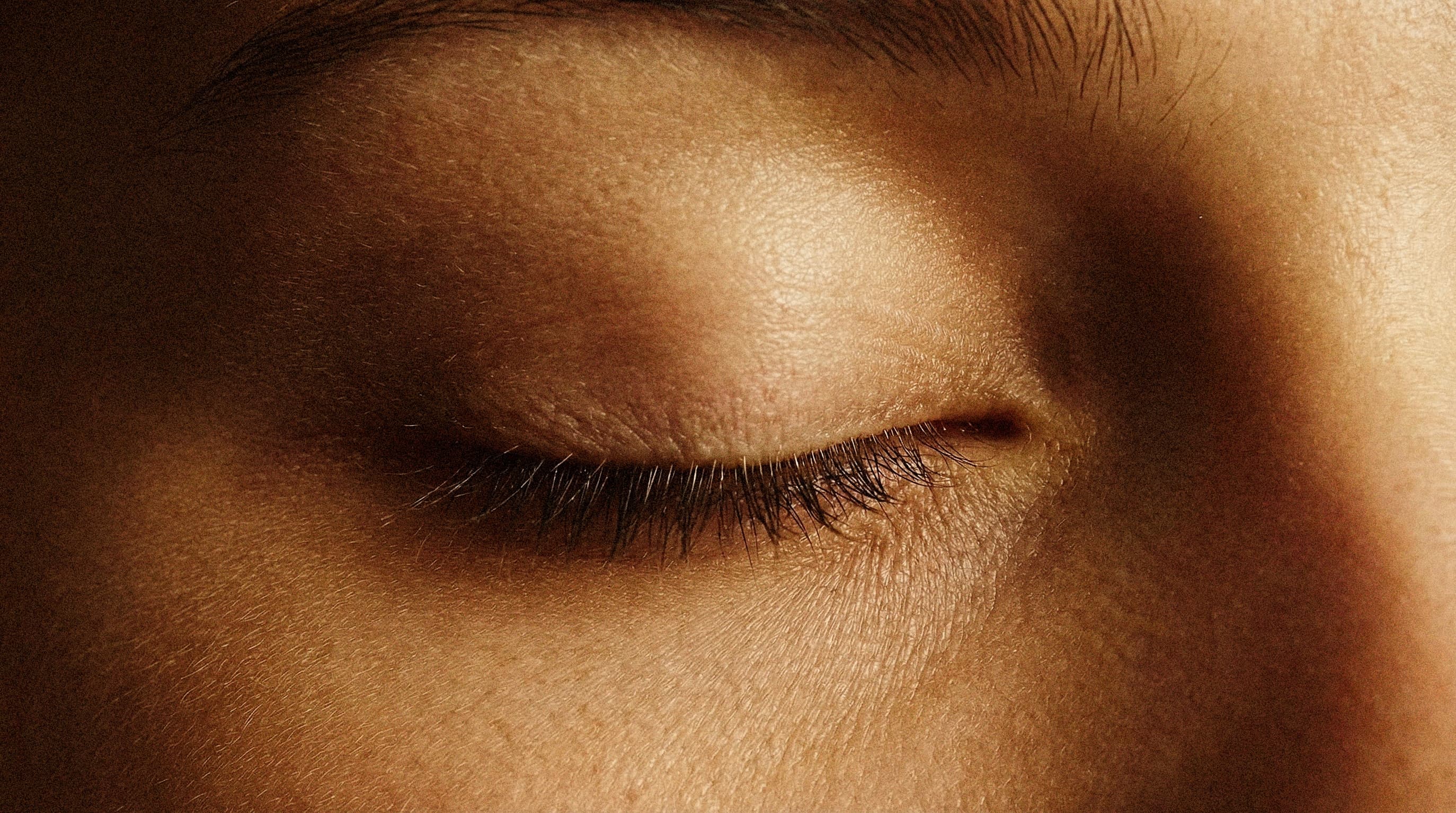 Lower Eyelid Surgery