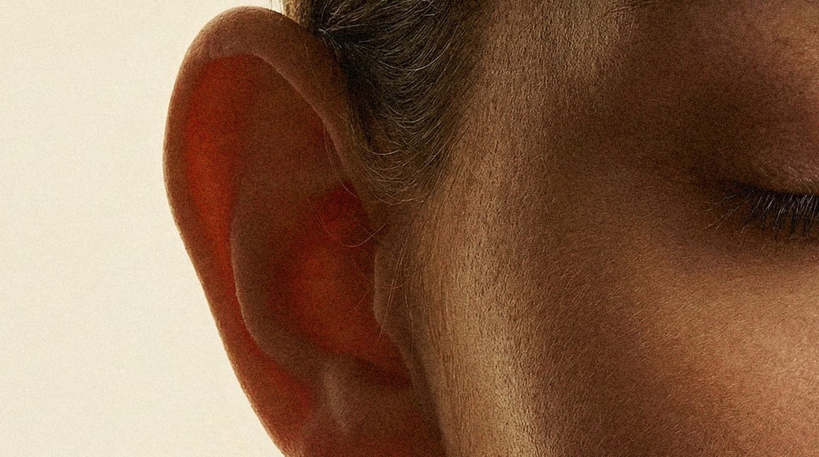 Otoplasty (Ear Aesthetics)