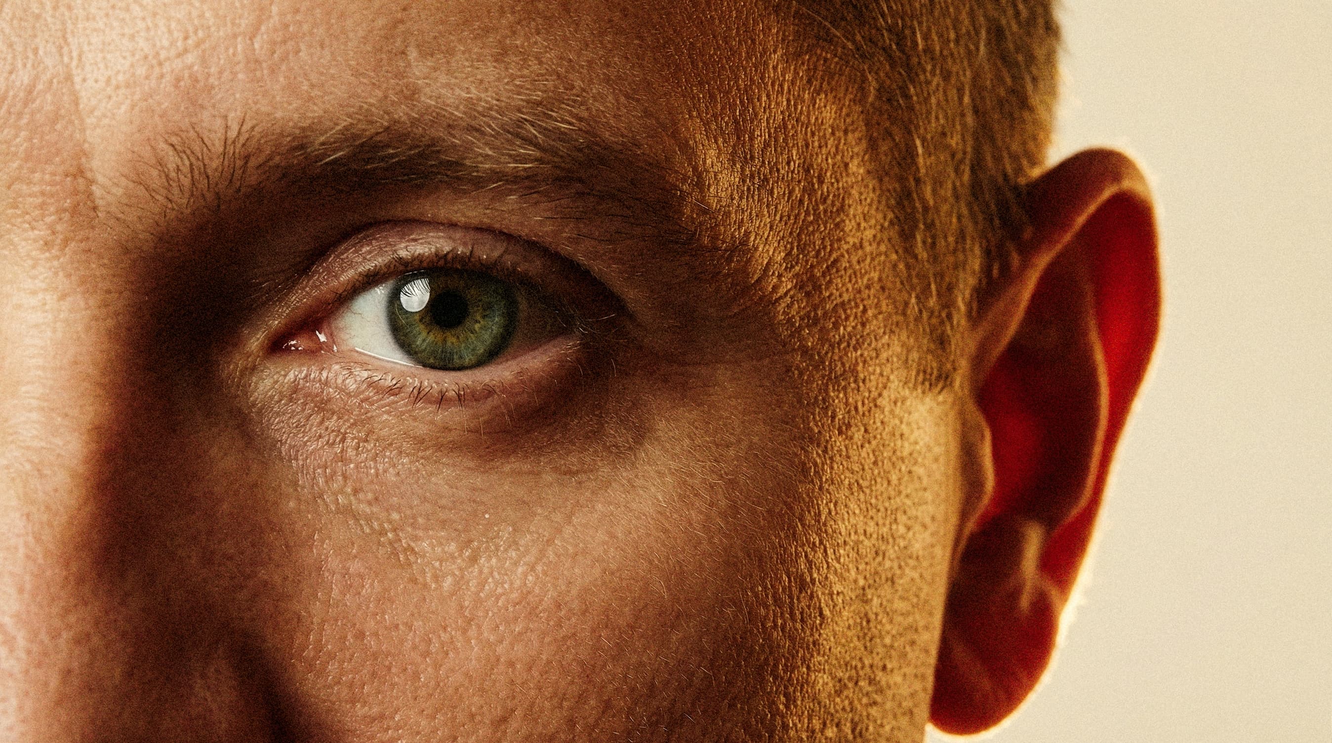 Upper Eyelid Aesthetics