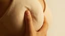 Breast Enlargement with Fat Filling